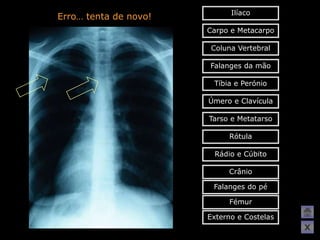 Ilíaco
Erro… tenta de novo!
                       Carpo e Metacarpo

                        Coluna Vertebral

                       Falanges da mão

                        Tíbia e Perónio

                       Úmero e Clavícula

                       Tarso e Metatarso

                            Rótula

                        Rádio e Cúbito

                            Crânio

                        Falanges do pé

                            Fémur

                       Externo e Costelas
                                            X
 