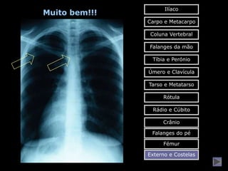 Ilíaco
Muito bem!!!
               Carpo e Metacarpo

                Coluna Vertebral

               Falanges da mão

                Tíbia e Perónio

               Úmero e Clavícula

               Tarso e Metatarso

                    Rótula

                Rádio e Cúbito

                    Crânio

                Falanges do pé

                    Fémur

               Externo e Costelas
 
