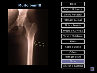 Ilíaco
Muito bem!!!
               Carpo e Metacarpo

                Coluna Vertebral

               Falanges da mão

                Tíbia e Perónio

               Úmero e Clavícula

               Tarso e Metatarso

                    Rótula

                Rádio e Cúbito

                    Crânio

                Falanges do pé

                    Fémur

               Externo e Costelas
 