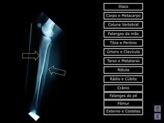 Ilíaco

Carpo e Metacarpo

 Coluna Vertebral

Falanges da mão

 Tíbia e Perónio

Úmero e Clavícula

Tarso e Metatarso

     Rótula

 Rádio e Cúbito

     Crânio

 Falanges do pé

     Fémur

Externo e Costelas
                     X
 
