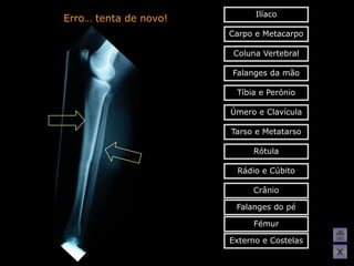 Ilíaco
Erro… tenta de novo!
                       Carpo e Metacarpo

                        Coluna Vertebral

                       Falanges da mão

                        Tíbia e Perónio

                       Úmero e Clavícula

                       Tarso e Metatarso

                            Rótula

                        Rádio e Cúbito

                            Crânio

                        Falanges do pé

                            Fémur

                       Externo e Costelas
                                            X
 