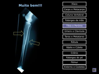 Ilíaco
Muito bem!!!
               Carpo e Metacarpo

                Coluna Vertebral

               Falanges da mão

                Tíbia e Perónio

               Úmero e Clavícula

               Tarso e Metatarso

                    Rótula

                Rádio e Cúbito

                    Crânio

                Falanges do pé

                    Fémur

               Externo e Costelas
 