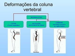 Deformações da coluna
        vertebral
                         DEFORMAÇÕES


                                                       LORDOSE
      CIFOSE                ESCOLIOSE
                                                   (curvatura excessiva
 (Costas arqueadas)   (desvio lateral da coluna)
                                                     na região lombar
 