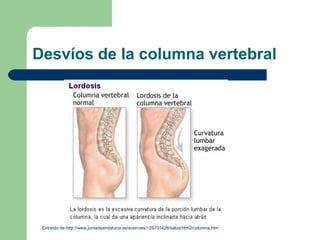 Desvíos de la columna vertebral
Extraído de:http://www.juntadeandalucia.es/averroes/~29701428/salud/htm2/columna.htm
 