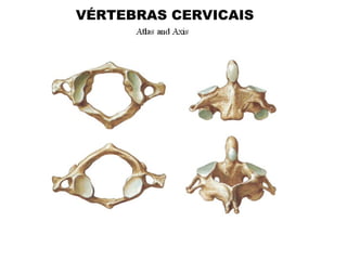 VÉRTEBRAS CERVICAIS
 
