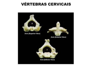 VÉRTEBRAS CERVICAIS
 