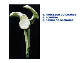 1. PROCESSO CORACÓIDE
4. ACRÔMIO
2. CAVIDADE GLENÓIDE
 