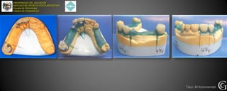 UNIVERSIDAD DEL SALVADOR
ASOCIACION ODONTOLOGICAARGENTINA
Escuela de Odontología
Cátedra de Prostodoncia I
Técn. M.Kommendat