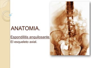 ANATOMIA.
Espondilitis anquilosante.
El esqueleto axial.
 