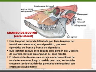 CARA LATERAL – PORCIÓN FACIALab15  Maxilar  (15)