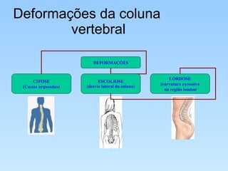 Deformações da coluna  vertebral  DEFORMAÇÕES CIFOSE (Costas arqueadas)‏ ESCOLIOSE (desvio lateral da coluna)‏ LORDOSE (curvatura excessiva  na região lombar 