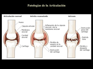 Patologías de la Articulación
 