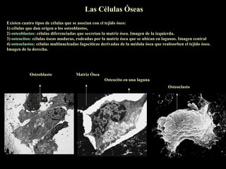 Las Células Óseas
Existen cuatro tipos de células que se asocian con el tejido óseo:
1) células que dan origen a los osteoblastos,
2) osteoblastos: células diferenciadas que secretan la matriz ósea. Imagen de la izquierda.
3) osteocitos: células óseas maduras, rodeadas por la matriz ósea que se ubican en lagunas. Imagen central
4) osteoclastos: células multinucleadas fagocíticas derivadas de la médula ósea que reabsorben el tejido óseo.
Imagen de la derecha.




            Osteoblasto              Matriz Ósea
                                                    Osteocito en una laguna
                                                                                       Osteoclasto
 