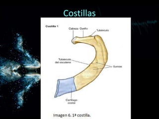 Costillas
 