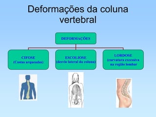 Deformações da coluna
              vertebral
                        DEFORMAÇÕES



                                                      LORDOSE
     CIFOSE                ESCOLIOSE
                                                  (curvatura excessiva
(Costas arqueadas)   (desvio lateral da coluna)
                                                    na região lombar
 