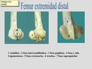 Femur extremidad distal 1 cóndilos.- 2 fosa intercondiloidea.- 3 fosa poplitea.- 4 fosa y tub.  Ligamentoso.- 5 fosa extensoria.- 6 troclea.- 7 fosa suprapatelar 1 2 3 4 5 6 7 PRAM FCV UNNE 