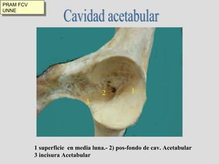 Cavidad acetabular 1 2 3 1 superficie  en media luna.- 2) pos-fondo de cav. Acetabular 3 incisura Acetabular  PRAM FCV UNNE 