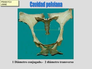 Cavidad pelviana 1 2 1 Diámetro conjugado.-  2 diámetro transverso PRAM FCV UNNE 