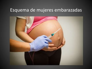 Esquema de mujeres embarazadas
 