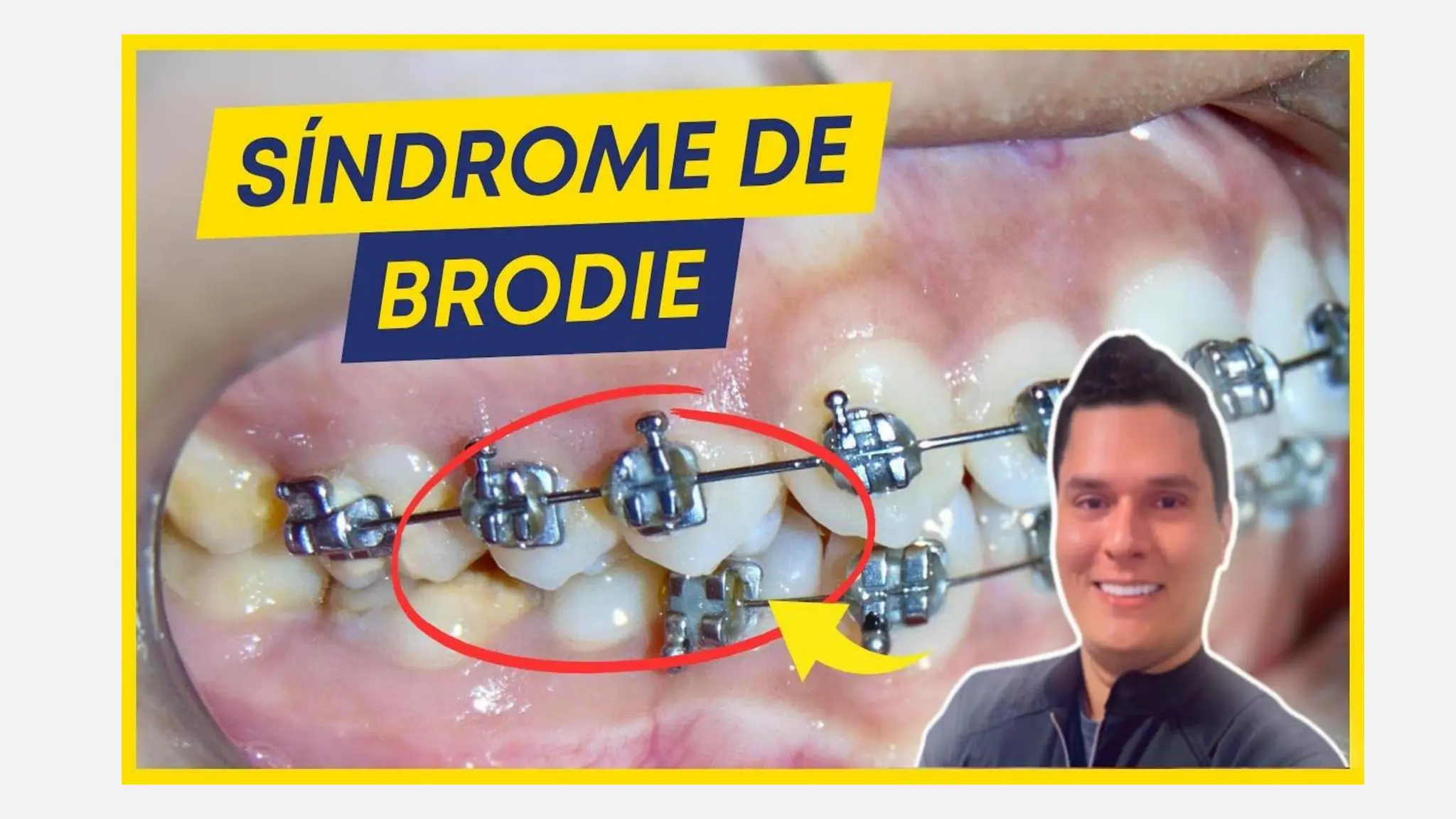 esquema de brodie ,indicsciones hy usos en la vida diaria | PDF ...