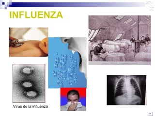 INFLUENZA Virus de la influenza 