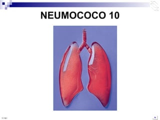 NEUMOCOCO 10 10:50 PM 