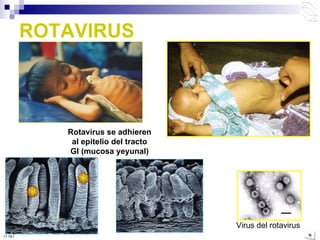 ROTAVIRUS Virus del rotavirus Rotavirus se adhieren al epitelio del tracto GI (mucosa yeyunal) 10:50 PM 