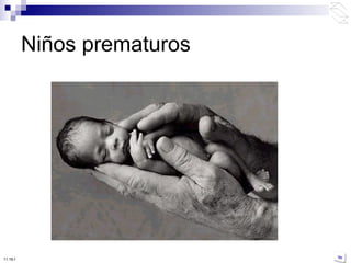 Niños prematuros 10:50 PM 
