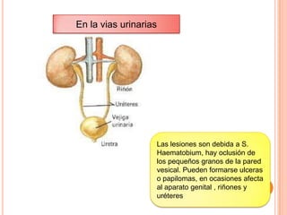colonHay infiltración celular