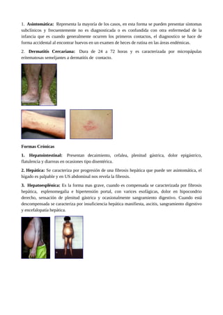 1. Asintomática: Representa la mayoría de los casos, en esta forma se pueden presentar síntomas
subclínicos y frecuentemente no es diagnosticada o es confundida con otra enfermedad de la
infancia que es cuando generalmente ocurren los primeros contactos, el diagnostico se hace de
forma accidental al encontrar huevos en un examen de heces de rutina en las áreas endémicas.
2. Dermatitis Cercariana: Dura de 24 a 72 horas y es caracterizada por micropápulas
eritematosas semeljantes a dermatitis de contacto.
Formas Crónicas
1. Hepatointestinal: Presentan decaimiento, cefalea, plenitud gástrica, dolor epigástrico,
flatulencia y diarreas en ocasiones tipo disentérica.
2. Hepática: Se caracteriza por progresión de una fibrosis hepática que puede ser asintomática, el
hígado es palpable y en US abdominal nos revela la fibrosis.
3. Hepatoesplénica: Es la forma mas grave, cuando es compensada se caracterizada por fibrosis
hepática, esplenomegalia e hipertensión portal, con varices esofágicas, dolor en hipocondrio
derecho, sensación de plenitud gástrica y ocasionalmente sangramiento digestivo. Cuando está
descompensada se caracteriza por insuficiencia hepática manifiesta, ascitis, sangramiento digestivo
y encefalopatía hepática.
 