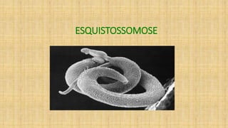ESQUISTOSSOMOSE
 