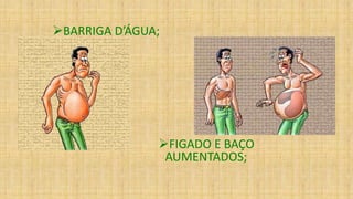 BARRIGA D’ÁGUA;
FIGADO E BAÇO
AUMENTADOS;
 