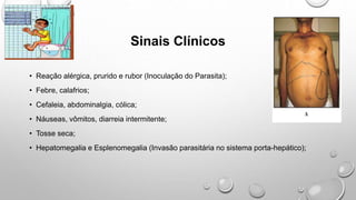 Sinais Clínicos
• Reação alérgica, prurido e rubor (Inoculação do Parasita);
• Febre, calafrios;
• Cefaleia, abdominalgia, cólica;
• Náuseas, vômitos, diarreia intermitente;
• Tosse seca;
• Hepatomegalia e Esplenomegalia (Invasão parasitária no sistema porta-hepático);
 
