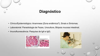 Diagnóstico
• Clínico/Epidemiológico: Anamnese (Zona endêmica?), Sinais e Sintomas;
• Laboratorial: Parasitologia de Fezes, Urocultura, Biópsia mucosa intestinal;
• Imunofluorescência: Pesquisa de IgA e IgG;
 