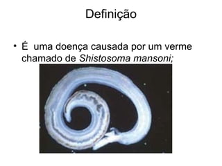 Definição É  uma doença causada por um verme chamado de  Shistosoma mansoni; 