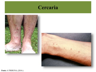 Cercaria
Fonte: A TRIBUNA, (2016.)
 