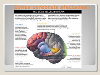Zonas cerebrais afectadas: 