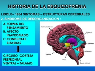 LIDDLE– 1984 SINTOMAS – ESTRUCTURAS CEREBRALES
2. SINDROME DE DESORGANIZACION :
A.FORMA DEL
PENSAMIENTO
B. AFECTO
INAPROPIADO
C.CONDUCTAS
BIZARRAS
CIRCUITO CORTEZA
PREFRONTAL
VENTRAL – TALAMO
 