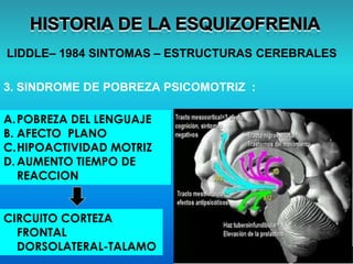 LIDDLE– 1984 SINTOMAS – ESTRUCTURAS CEREBRALES
3. SINDROME DE POBREZA PSICOMOTRIZ :
A.POBREZA DEL LENGUAJE
B. AFECTO PLANO
C.HIPOACTIVIDAD MOTRIZ
D.AUMENTO TIEMPO DE
REACCION
CIRCUITO CORTEZA
FRONTAL
DORSOLATERAL-TALAMO
 