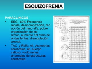 PARACLINICOS
• EEG: 60% Frecuencia
rápida, desincronización, red
ucción del ritmo alfa, pobre
organización de los
ritmos, aumento del ritmo de
ondas lentas, disregulación
axonal.
• TAC y RMN: Alt. Asimetrías
cerebrales, alt. cuerpo
calloso, vvolúmenes
anormales de estructuras
cerebrales.
 