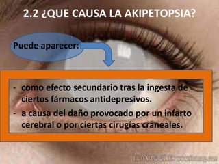 2.2 ¿QUE CAUSA LA AKIPETOPSIA?
Puede aparecer:

- como efecto secundario tras la ingesta de
ciertos fármacos antidepresivos.
- a causa del daño provocado por un infarto
cerebral o por ciertas cirugías craneales.

 