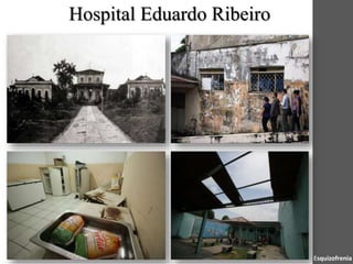 Hospital Eduardo Ribeiro
Esquizofrenia
 