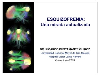 ESQUIZOFRENIA:
Una mirada actualizada
DR. RICARDO BUSTAMANTE QUIROZ
Universidad Nacional Mayor de San Marcos
Hospital Víctor Larco Herrera
Cusco, Junio 2015
1
 