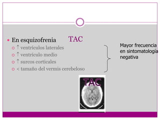 TACEn esquizofrenia ventrículos laterales ventrículo medio surcos corticales< tamaño del vermis cerebelosoMayor frecuencia en sintomatología negativa