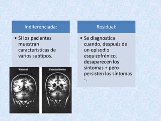 Indiferenciada:
• Si los pacientes
muestran
características de
varios subtipos.
Residual:
• Se diagnostica
cuando, después de
un episodio
esquizofrénico,
desaparecen los
síntomas + pero
persisten los síntomas
-.
 