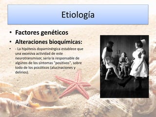 Etiología
• Factores genéticos
• Alteraciones bioquímicas:
• - La hipótesis dopaminérgica establece que
una excesiva actividad de este
neurotransmisor, sería la responsable de
algunos de los síntomas "positivos", sobre
todo de los psicóticos (alucinaciones y
delirios).
 