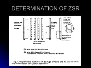 DETERMINATION OF ZSR 