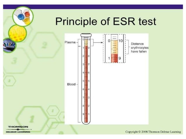 Erythrocyte Sedimentation Rate | PPTX