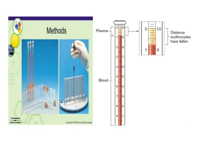 What is the importance of a sedimentation rate blood test?