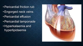 •Pericardial friction rub
•Engorged neck veins
•Pericardial effusion
•Pericardial tamponade
•Hyperkalaemia and
hyperlipidaemia
 